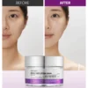 VT  Reedle Shot Lifting Cream