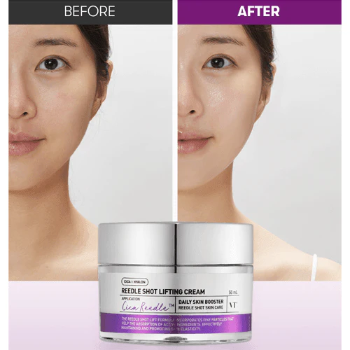 VT  Reedle Shot Lifting Cream