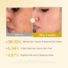 71Mi7n2IgaL._AC_SL1500_ medicube Kojic Acid Turmeric Resurfacing Toner