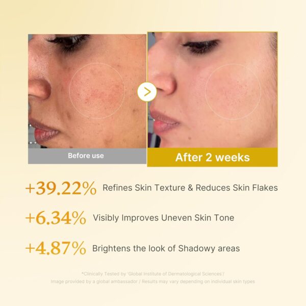 71Mi7n2IgaL._AC_SL1500_ medicube Kojic Acid Turmeric Resurfacing Toner