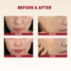 k-secret-seoul-1998-cream-snail-mucin-93-rice-100-ml-before-after_1024x1024 K-SECRET SEOUL 1998 Cream: Snail Mucin 93% + Rice 100ml