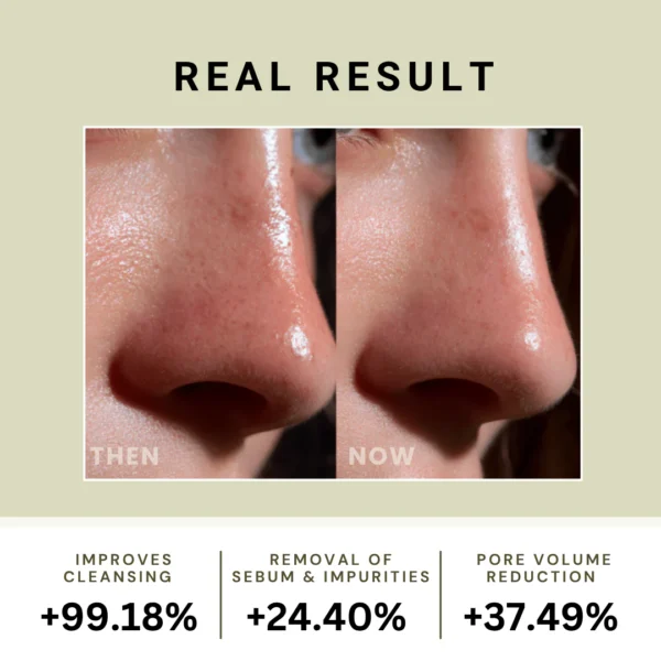 19 P.CALM Holy Basil Bubble Deep Mask