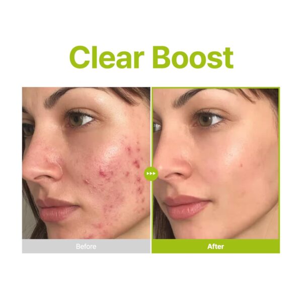 51ZyjgoFyqL._SL1080_ Purito Azelaic Acid 10 Kojic Tea Tree Serum