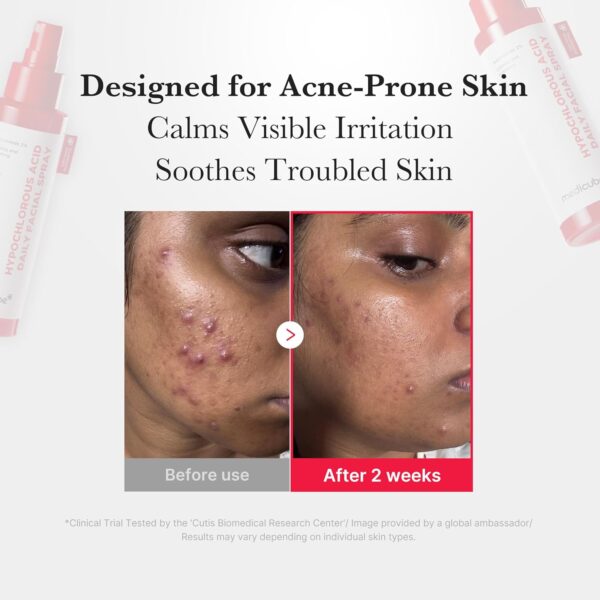 medicube Hypochlorous Acid Daily Facial Spray 50ml