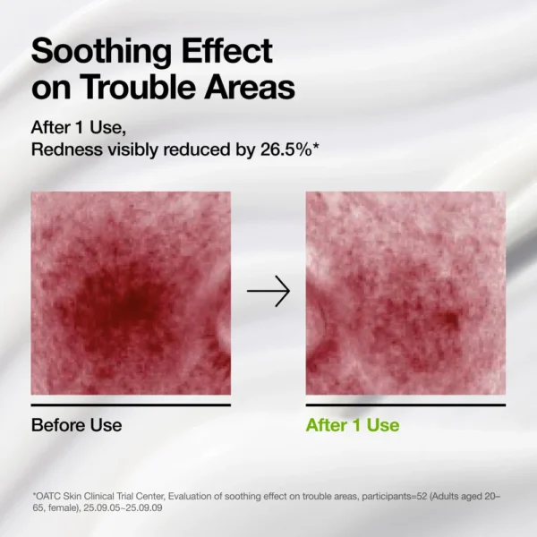 ANUA AZELAIC ACID CICA SKIN SOOTHING MOISTURIZER 100ml