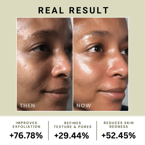 BR MUD RELIEF MUD MASK