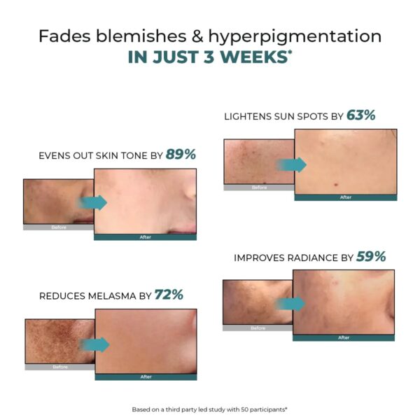 img_7684 Trubiom Pigmentation & Dark Spots Treatment Serum