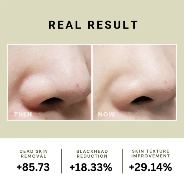 BR MUD RELIEF MUD PEEL OFF MASK