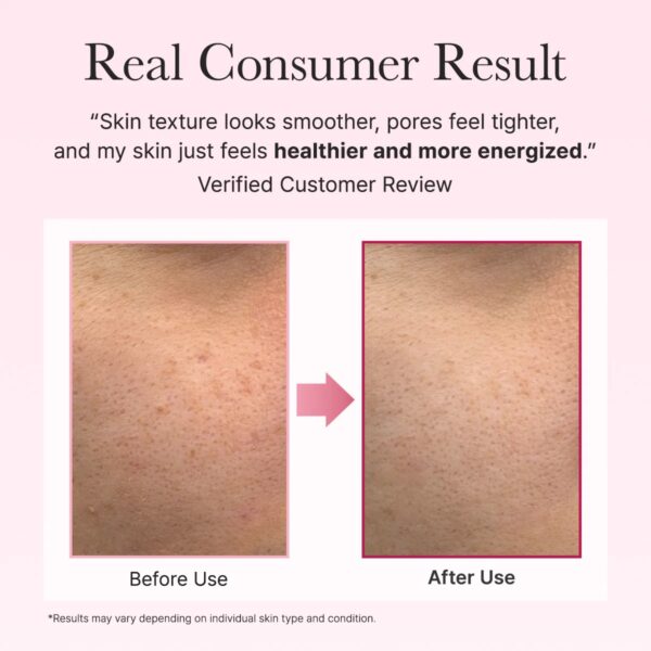 img_8004 Arencia PDRN Booster Shot