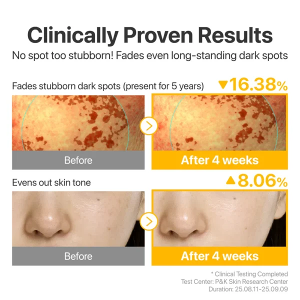251001_5_-04 Numbuzin No.5 Glutathione TXA Advanced Dark Spot Ampoule Concentrate