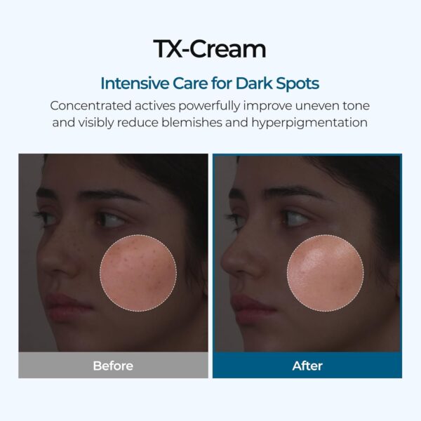 Dr.Melaxin TX Tranexamic Acid Cream