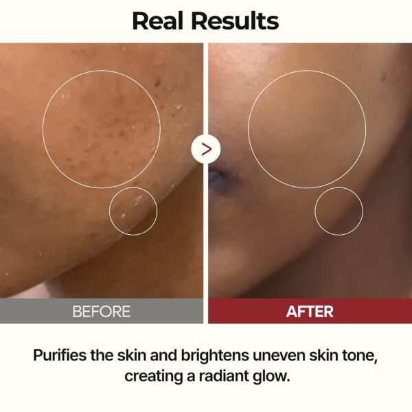 71k2auy6B7L._SL1500_ Dr.Melaxin PEEL SHOT GLOW WHITE RICE TONER 200ml