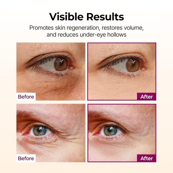 Dr.Melaxin CEMENRETE CALCIUM VOLUME MULTI BALM