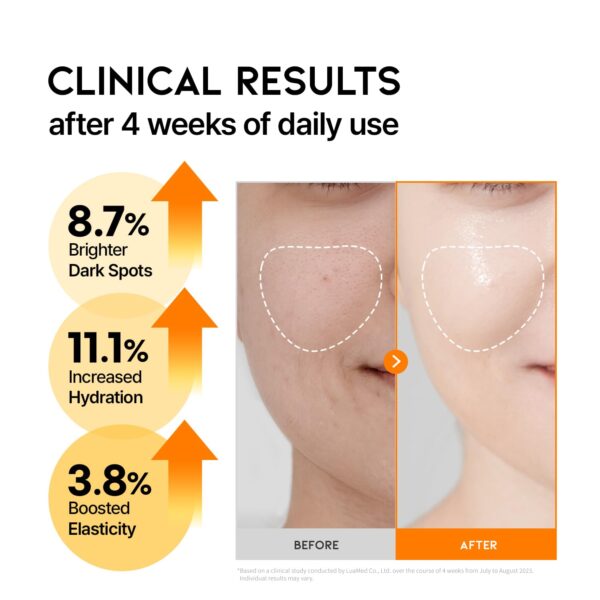 617I6IKW0EL._SL1500_ OOTD Dark Spot Vitamin C Serum 50ml