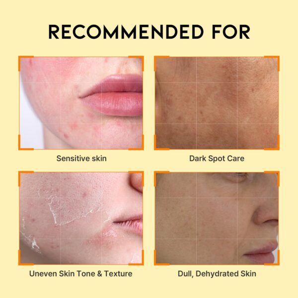 71yLmrj4K-L._SL1500_ OOTD Dark Spot Vitamin C Serum 50ml